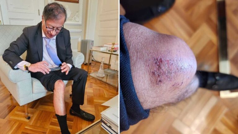 A Petro se le «trabaron» las piernas